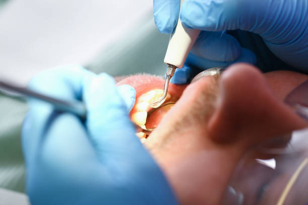 Best Emergency Denture Repair in Alorton, IL