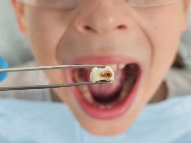 Best Emergency Treatment for Jaw Pain or Injury in Alorton, IL